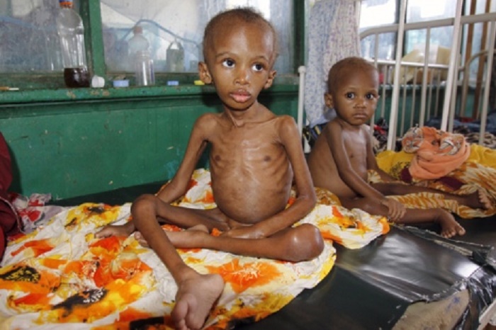 The Global Alliance for Improved Nutrition (GAIN), an international organisation founded by the Bill and Melinda Gates Foundation and driven by the mission of a world without malnutrition- is hosting the first-ever Nutrition Africa Investor Forum (NAIF) in Nairobi, Kenya, on October 16-17.