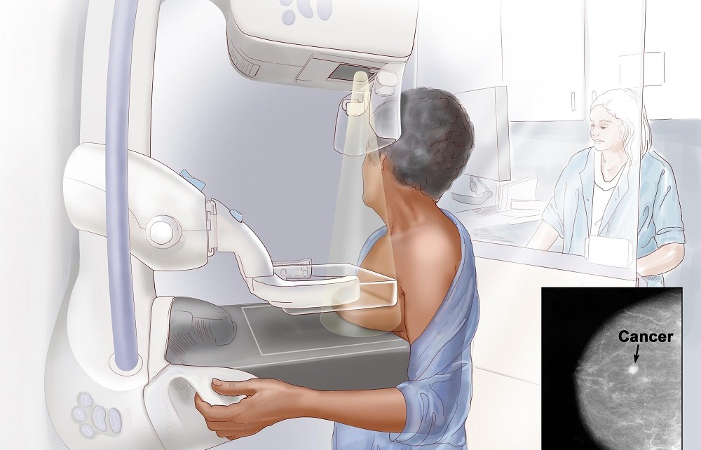The Nyeri County Government, Ministry of Health’s National Cancer Control Program (NCCP) and GE Healthcare have launched a Mammography screening campaign across Nyeri County to promote early detection of breast cancer.