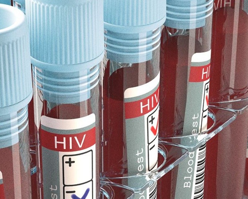 A team of scientists from Abbott have identified a new subtype of the human immunodeficiency virus (HIV), called HIV-1 Group M, subtype L.