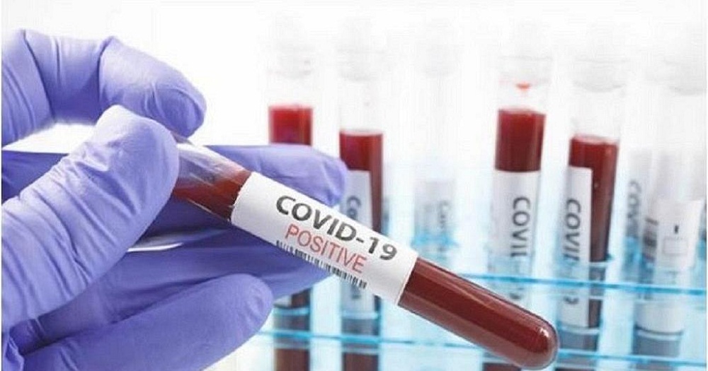 Forty more Ugandans have tested positive for COVID- 19 to bring the total number of infected Ugandans to 457.